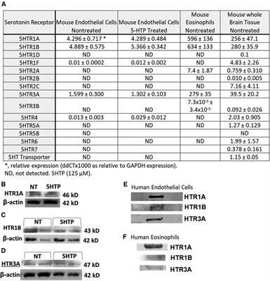 5-HTP inhibits eosinophilia via intracellular endothelial 5-HTRs; SNPs in 5-HTRs associate with asthmatic lung function